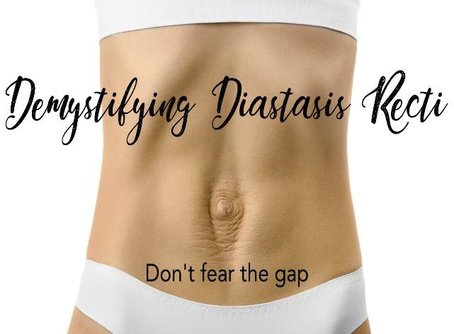 Diastasis-Recti